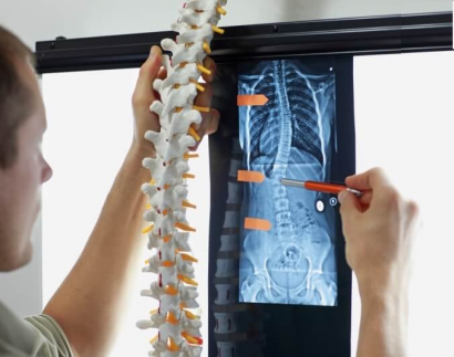 Thoái Hóa Đốt Sống Lưng Nguyên Nhân và Cách Điều Trị