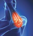 Đau khớp khuỷu tay có nguy hiểm không nguyên nhân và điều trị