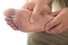 Điều trị nhanh bệnh tê bì chân tay 